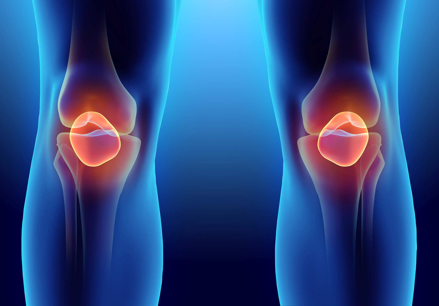 Does ozone therapy help with osteoarthritis?
